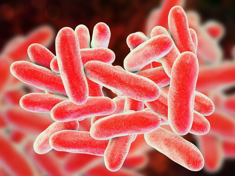 What Is the Most Common Way of Contracting Legionnaires’ and Legionella?